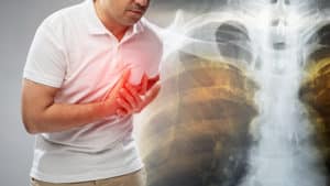 Problemas caardiacos