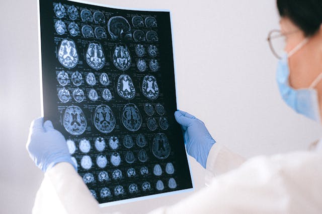 La RMN: Imágenes Claras para Diagnósticos Precisos